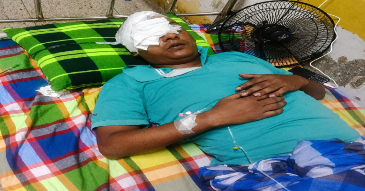 গাছ কাটাকে কেন্দ্র করে কেন্দুয়ায় সংঘর্ষ, গুরুতর আহত ব্যবসায়ী ঢাকা মেডিকেলে